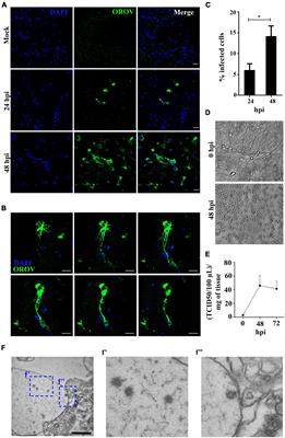 Neural Infection by Oropouche Virus in Adult Human - Frontiers